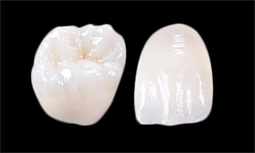 Cabinet dentaire Odontea - Prothèses dentaires