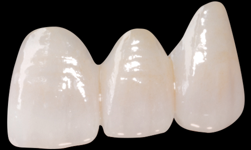 Cabinet dentaire Odontea - Prothèses dentaires